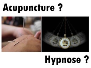 Lire la suite à propos de l’article Acupuncture ou Hypnose pour Arrêter de Fumer